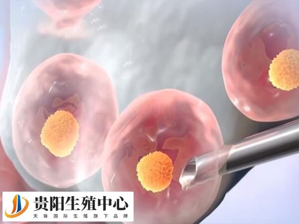 降调促排是试管婴儿的流程之一