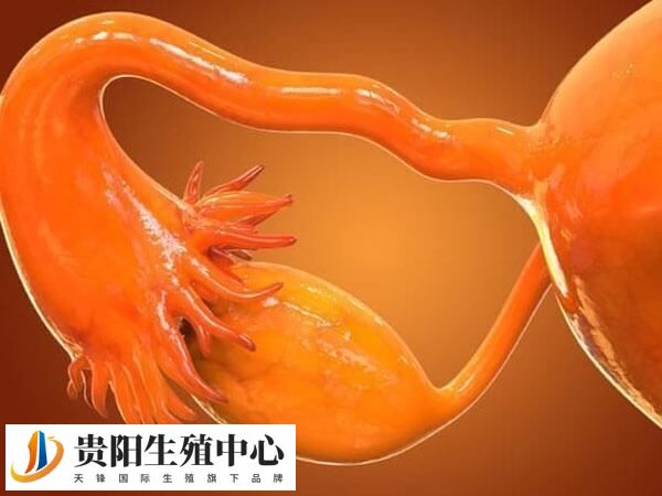 输卵管阻塞可以选择试管婴儿助孕