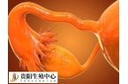 输卵管堵塞要不要做试管婴儿